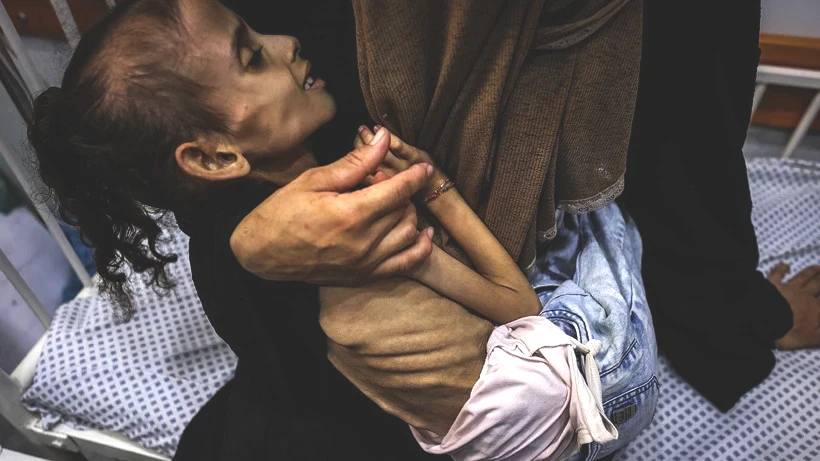 Bu Fotoğraflara Bakmaya Yürek Dayanmaz: Gazze'de Açlık Can Almaya Devam Ediyor! Minik Bedenler Göz Göre Ölüyor - Resim: 9