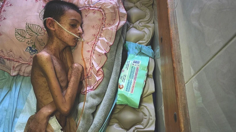Bu Fotoğraflara Bakmaya Yürek Dayanmaz: Gazze'de Açlık Can Almaya Devam Ediyor! Minik Bedenler Göz Göre Ölüyor - Resim: 6