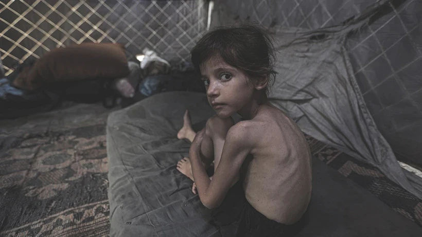 Bu Fotoğraflara Bakmaya Yürek Dayanmaz: Gazze'de Açlık Can Almaya Devam Ediyor! Minik Bedenler Göz Göre Ölüyor - Resim: 5