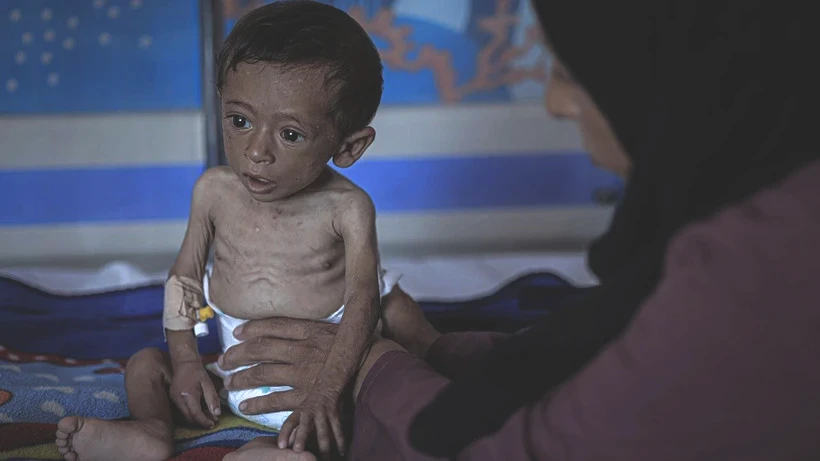 Bu Fotoğraflara Bakmaya Yürek Dayanmaz: Gazze'de Açlık Can Almaya Devam Ediyor! Minik Bedenler Göz Göre Ölüyor - Resim: 8