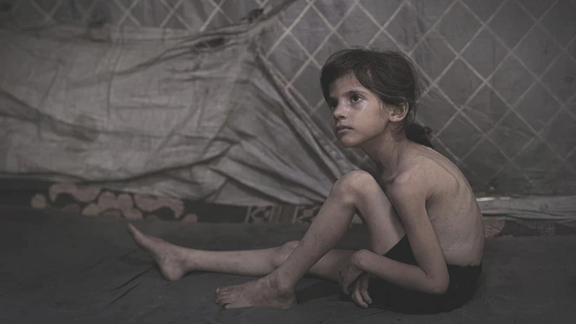 Bu Fotoğraflara Bakmaya Yürek Dayanmaz: Gazze'de Açlık Can Almaya Devam Ediyor! Minik Bedenler Göz Göre Ölüyor - Resim: 2