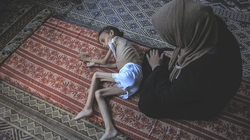 Bu Fotoğraflara Bakmaya Yürek Dayanmaz: Gazze'de Açlık Can Almaya Devam Ediyor! Minik Bedenler Göz Göre Ölüyor - Resim: 10