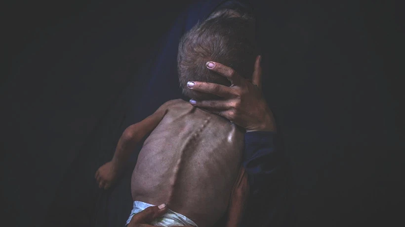 Bu Fotoğraflara Bakmaya Yürek Dayanmaz: Gazze'de Açlık Can Almaya Devam Ediyor! Minik Bedenler Göz Göre Ölüyor - Resim: 11