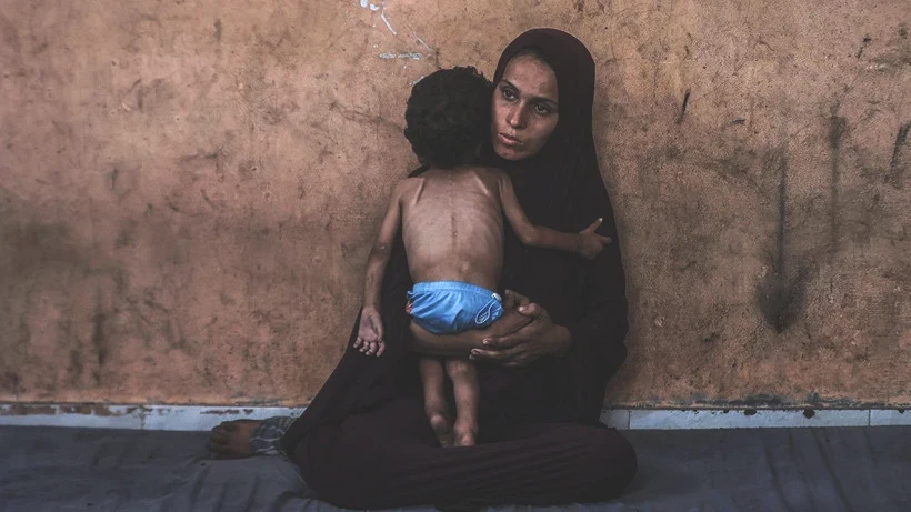 Bu Fotoğraflara Bakmaya Yürek Dayanmaz: Gazze'de Açlık Can Almaya Devam Ediyor! Minik Bedenler Göz Göre Ölüyor - Resim: 4
